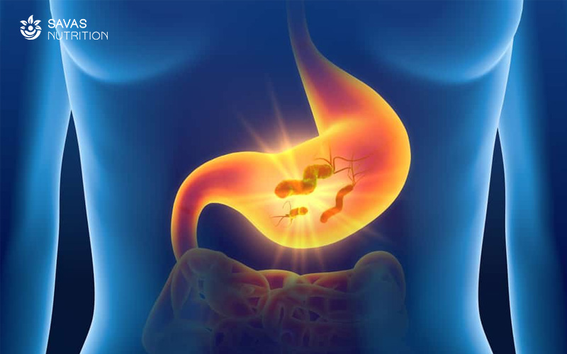Nguyên nhân đau dạ dày: Viêm ruột thừa
